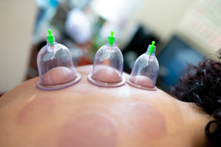 Unlocking the Benefits of Dry Cupping Therapy at Home: A Guide to Using an At-Home Kit