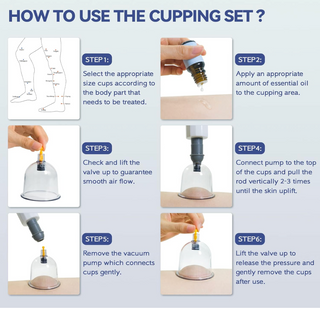 32 Piece Cupping Therapy Kit